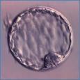 Blastocyst