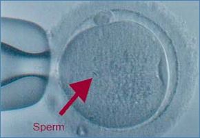 Sperm left inside